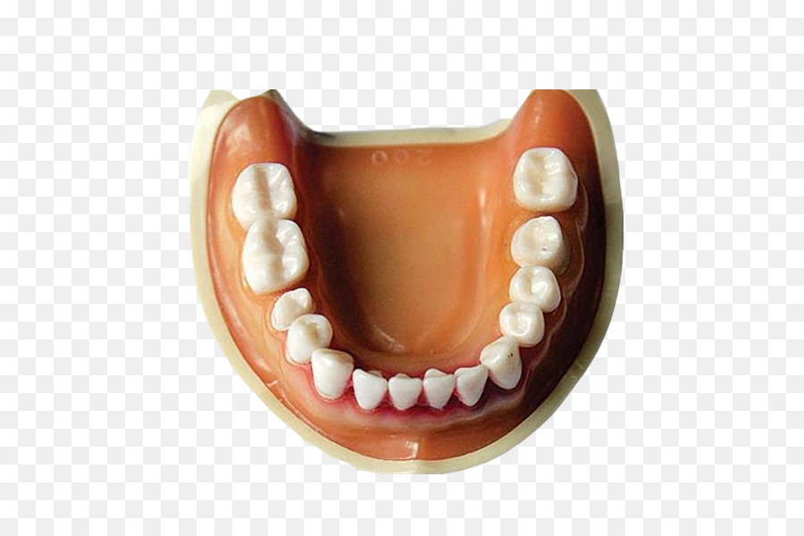 Răng Răng Giả, Nguyên Mẫu Vương Miện - Miễn phí răng giả kéo liệu