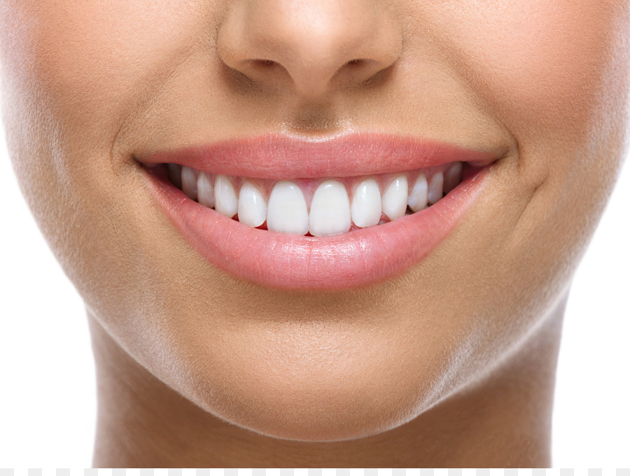 Zahnaufhellung Kosmetische Zahnmedizin Lächeln - Zähne