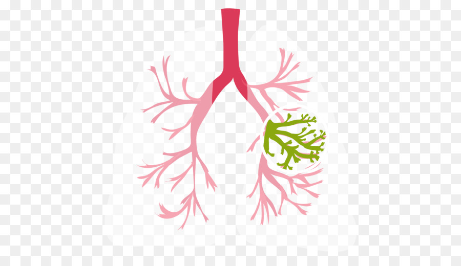 Zystische-Fibrose-Lungen-Medizinische Diagnose Symptom Einsamen pulmonale Knötchen - Lunge