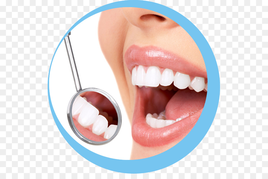 Kosmetische Zahnmedizin Zahnersatz Karies - Zahnmedizin