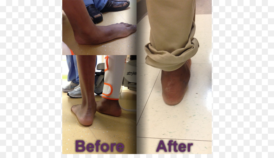 Knöchel-Fuß-Flat feet Fußpflege Joint - glückliche Füße