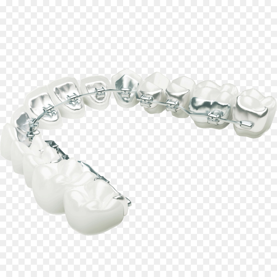 Linguale bretelle Ortodonzia Dentale parentesi graffe Chiaro allineatori Ortodontici tecnologia - Le parentesi graffe