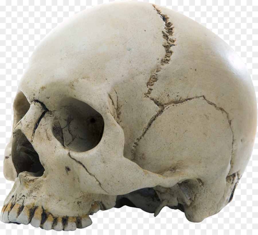 Faserigen Gelenks Menschliche Skelett Schädel Knochen - Schädel