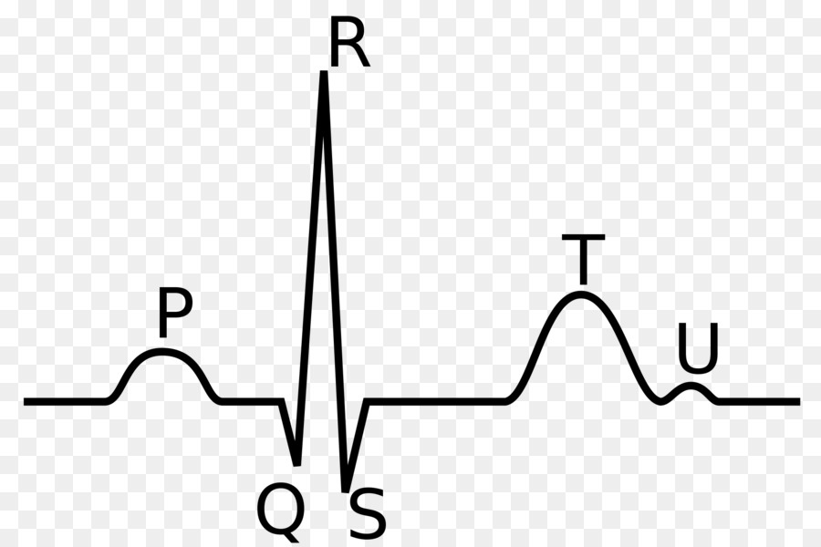 QRS-Komplex EKG P-Welle Herz-Depolarisation - EKG