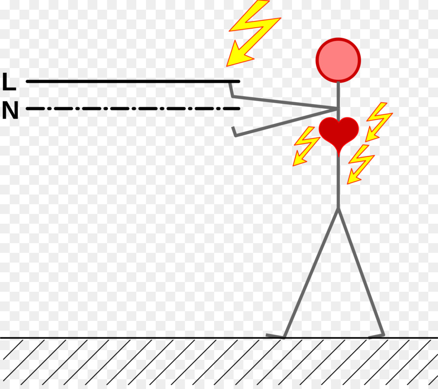 Elektrische Verletzungen Strom Diagramm clipart - Unfall