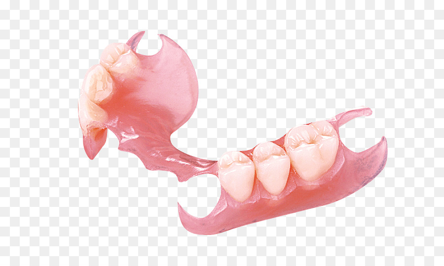 Der herausnehmbare Zahnersatz Zahnersatz Zahnmedizin, Krone - teilweise