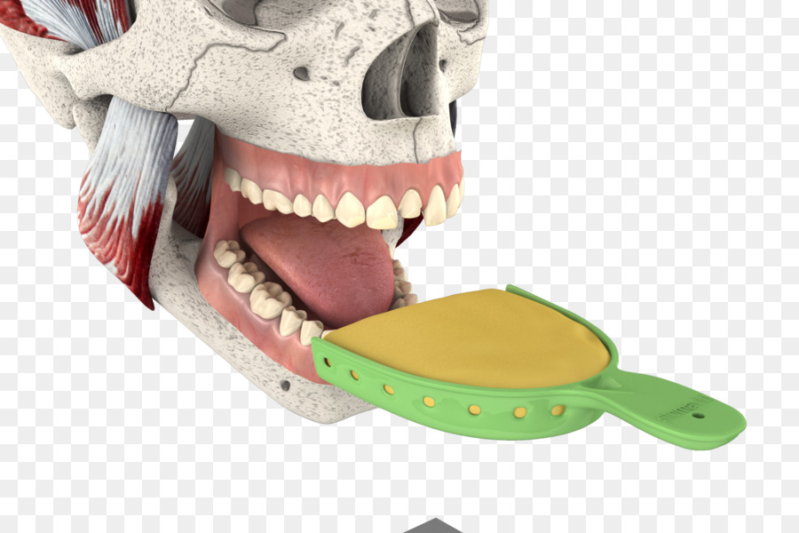 mascella - 3d dente di riparazione