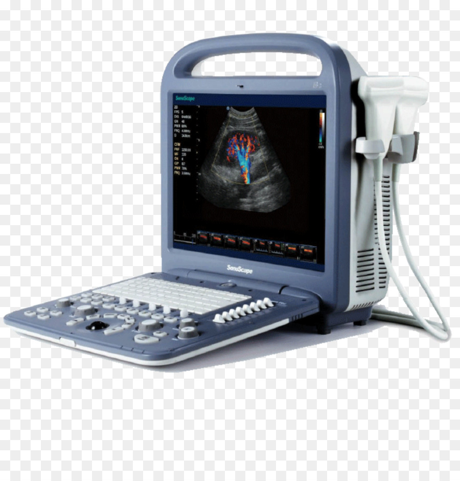 L'ecocardiografia Doppler Portatile ad ultrasuoni Ecografia SonoScape Medical Corp - pratico e colorato inkstone