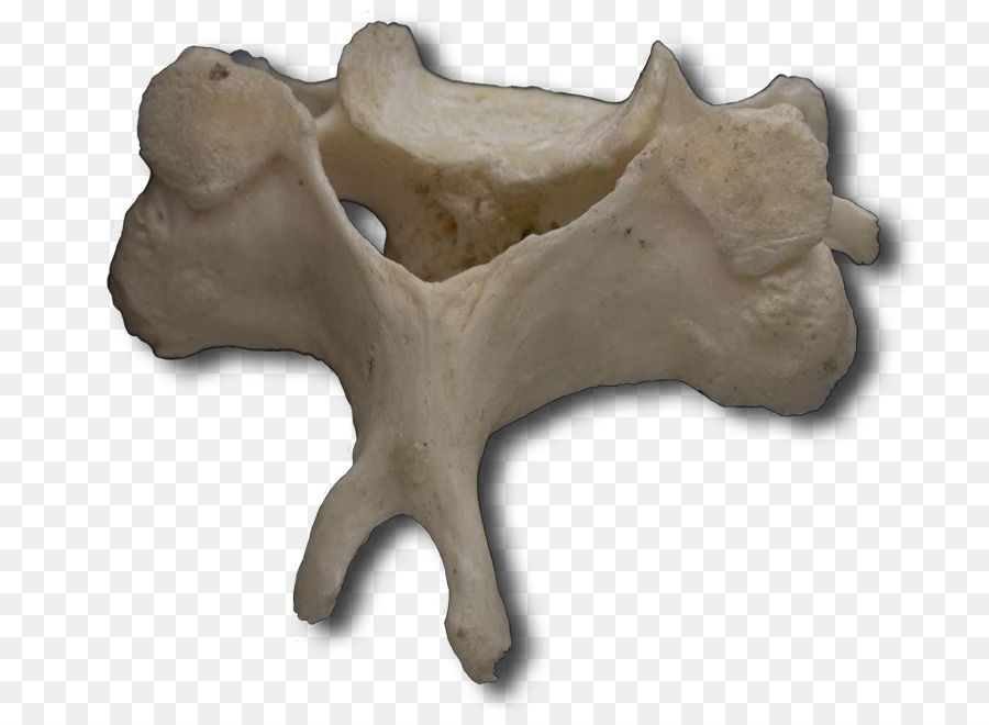 Umana colonna vertebrale, vertebre Cervicali Atlas - vertebrale