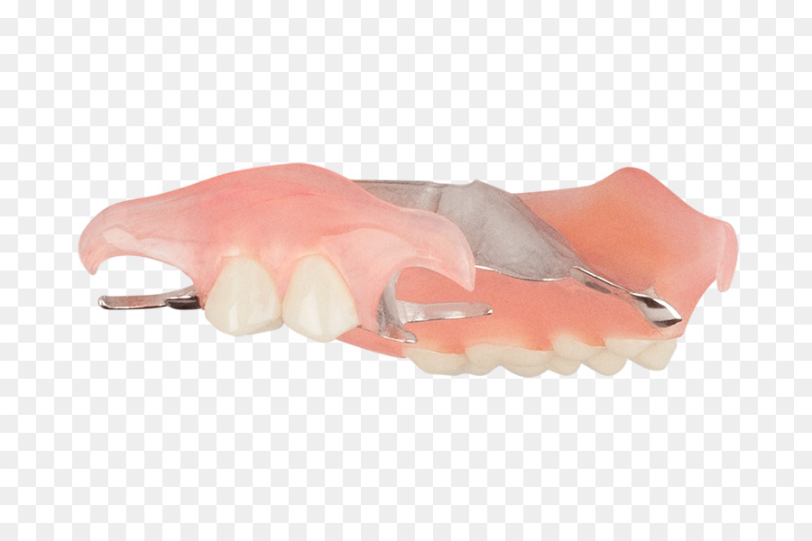 Răng giả Rời hàm răng giả một phần Răng Nha khoa cải thiện Nhà - góc