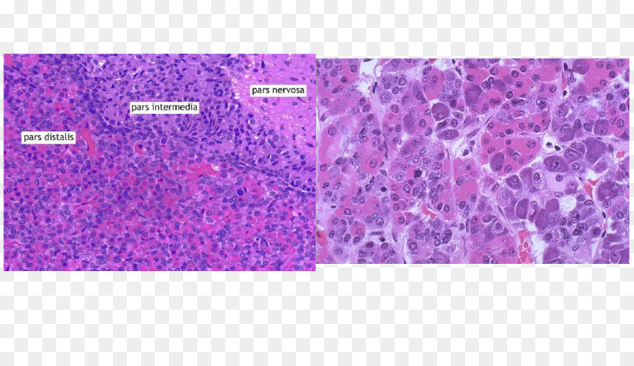 Pituitaria anteriore Acidophil di cellule ghiandola Ipofisaria di ormone Follicolo-stimolante Istologia - ipofisi