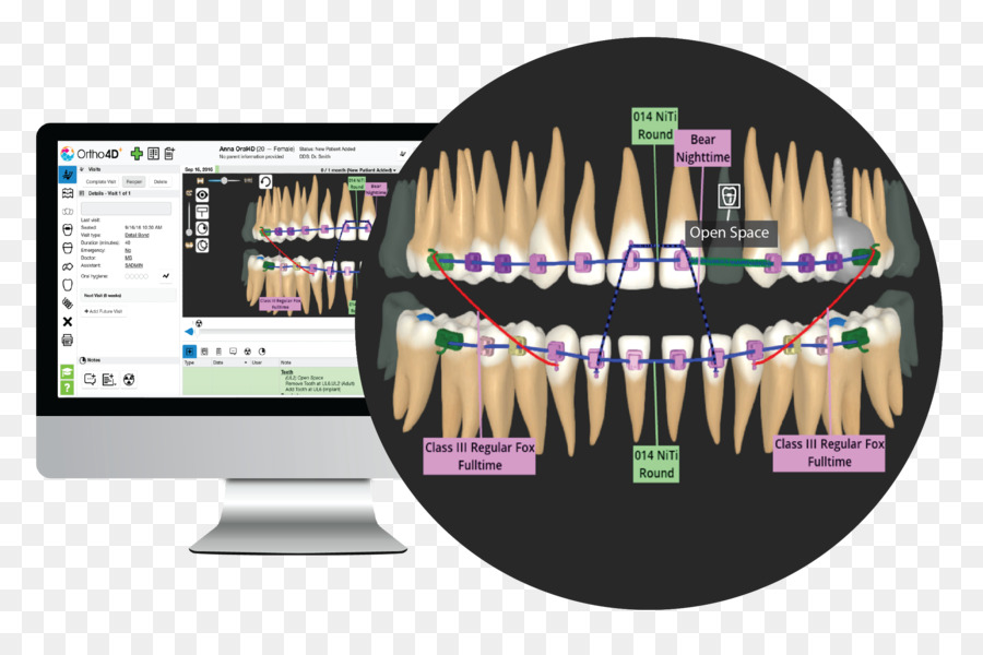Kieferorthopädie Menschlichen zahn Clear-Aligner Zahnmedizin - 3d dental health chart