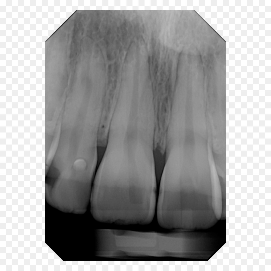 Digitale Radiographie X-ray Dental Radiographie Cone-beam-Computertomographie - x ray Einheit