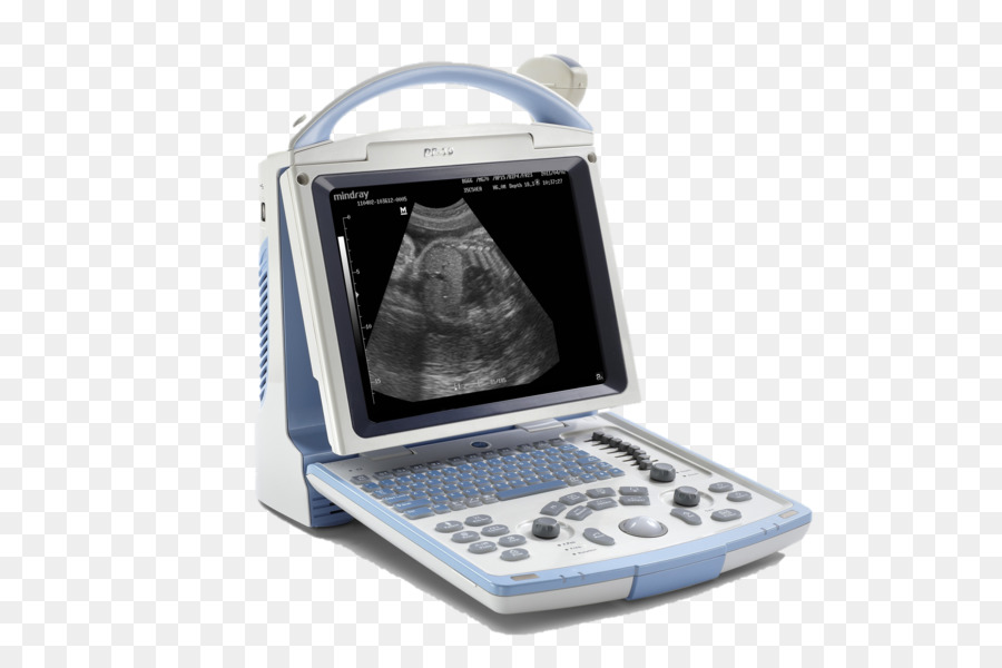 Ecografia a Ultrasuoni di Mindray Medicina ecocardiografia Doppler - altri