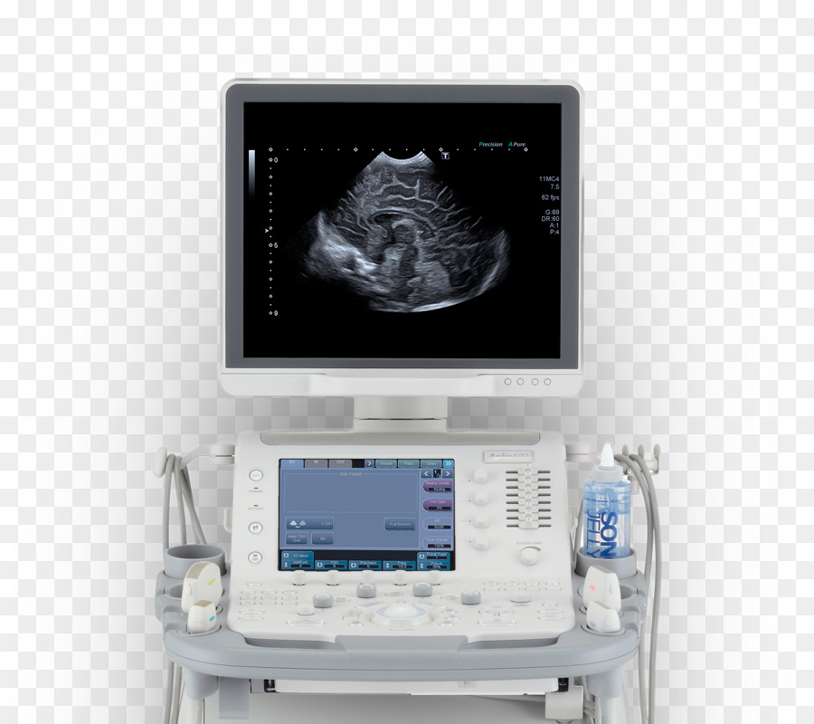 Sonographie Ultraschall der Medizinischen Diagnostik Patienten Mindray - andere