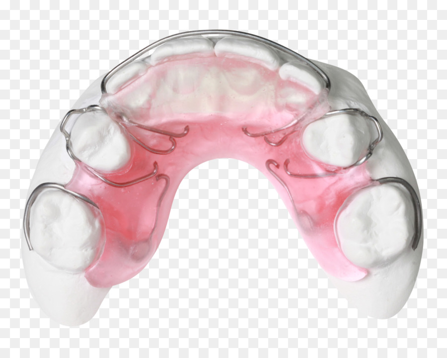 Gergen dell'Ortodonzia Laboratorio Ortodontico tecnologia Gergens ortodonzia Laboratorio di Ortodonzia Bionator - altri