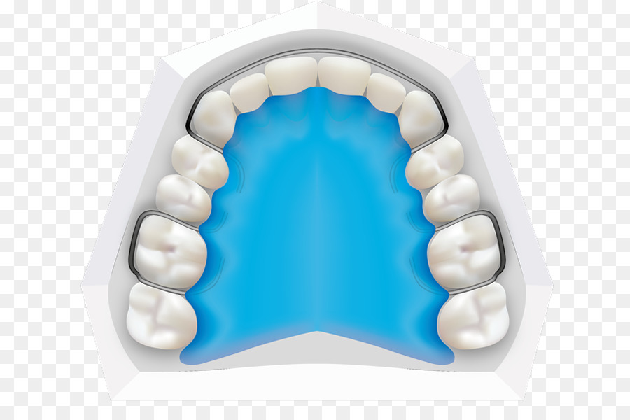 Zahn, Orthodontie, Zahnspangen, Zahnmedizin, Kieferorthopäde - andere