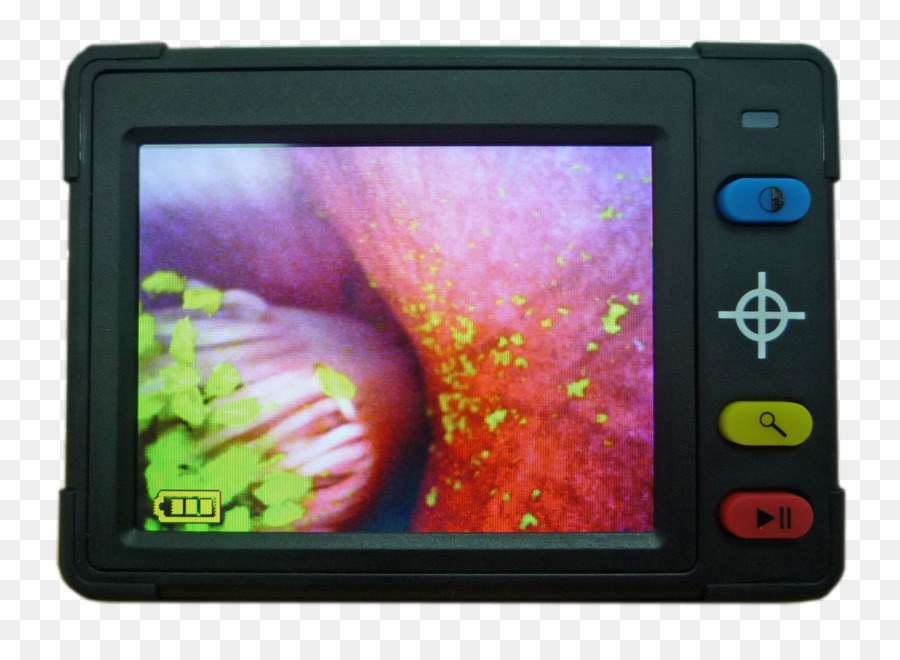 Lupe Elektronik die Daten Digital Mikroskop LCD-display - Lupe