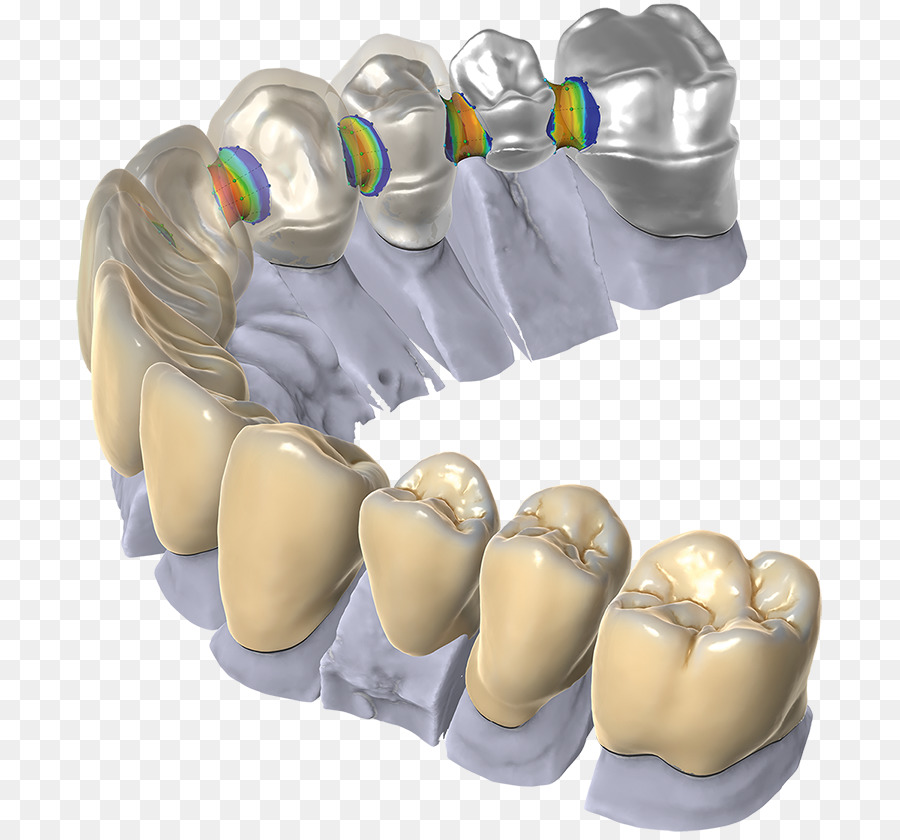 Odontoiatria CAD/CAM (Computer-aided design restauro Dentale Computer  Software - altri scaricare png - Disegno png trasparente Mascella png  scaricare.