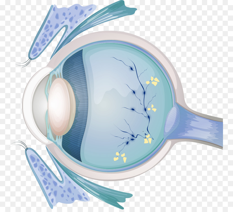 Optiker Augen-Untersuchung Diabetische Retinopathie Visuelle Wahrnehmung - Auge