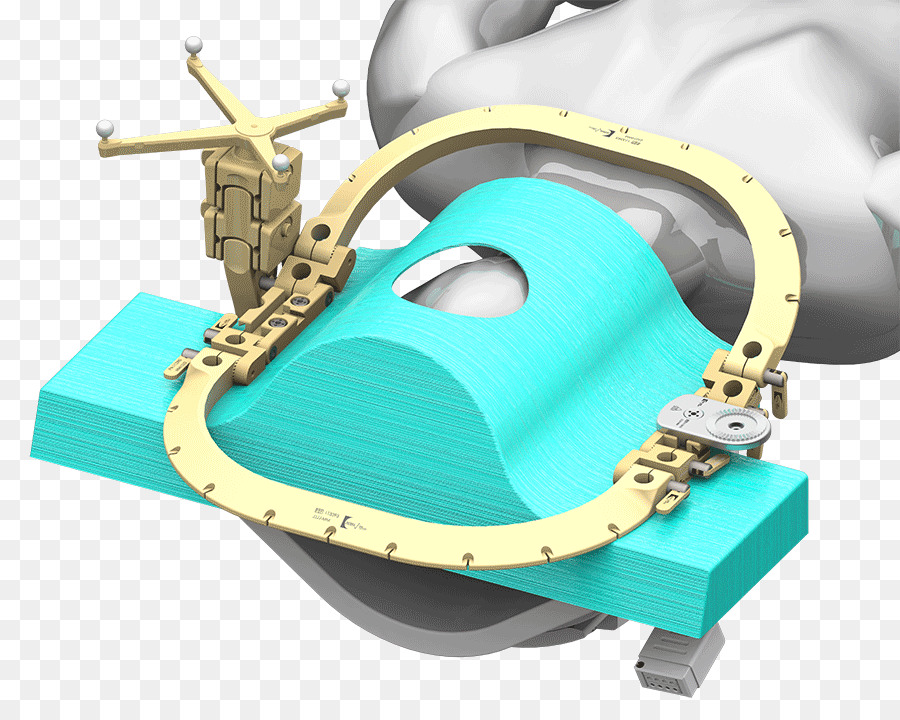 Neurochirurgie Magnetresonanztomographie Brainlab Intraoperative MRI Kraniotomie - Modellversuch