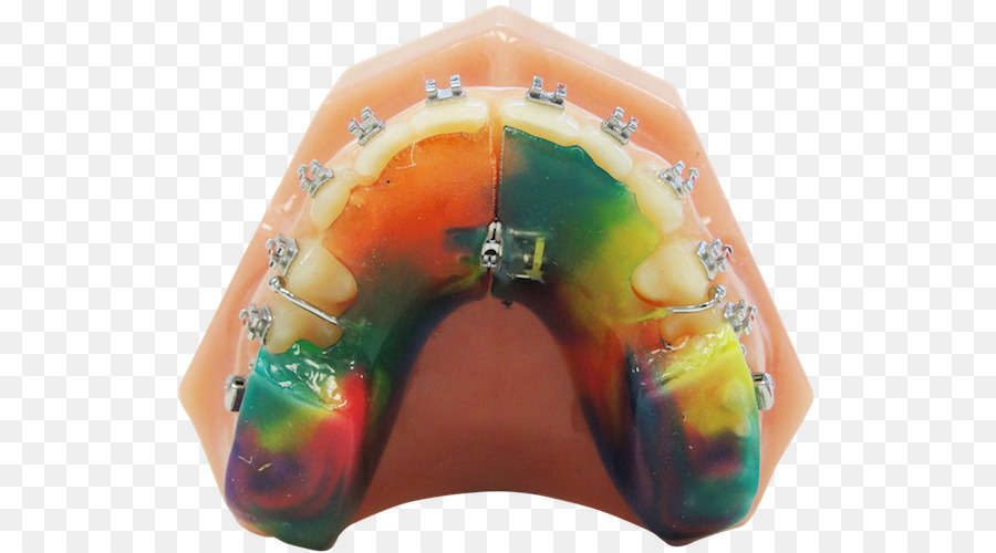 ROA - Ricoh Apparecchi Ortodontici Twin Block Apparecchio di Ortodonzia Fermo elettrodomestico - altri