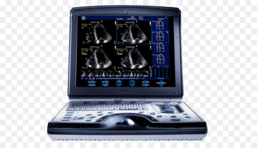 Ultraschall SonoSite, Inc. GE Healthcare Kardiologie Medizinische Geräte - andere
