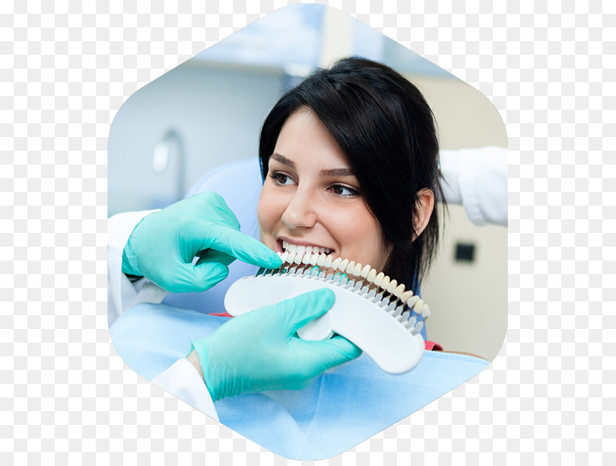 Zahnaufhellung, Zahnarzt, Menschlicher zahn, Zahnersatz - andere