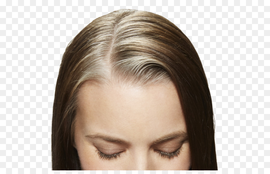 Capelli biondi colorare Modello di perdita dei capelli Parrucca - capelli