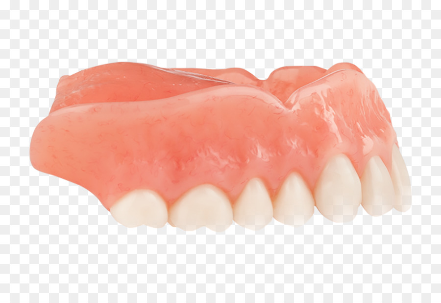 Zahn Zahnersatz - andere