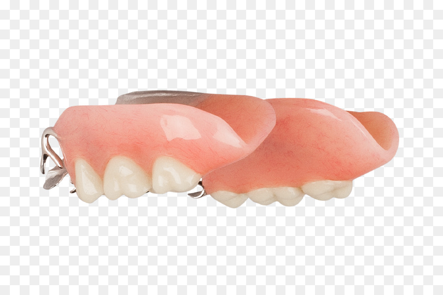 Dente protesi parziale Rimovibile Protesi Odontoiatria Aspen Dentaria - Aspen Dentaria
