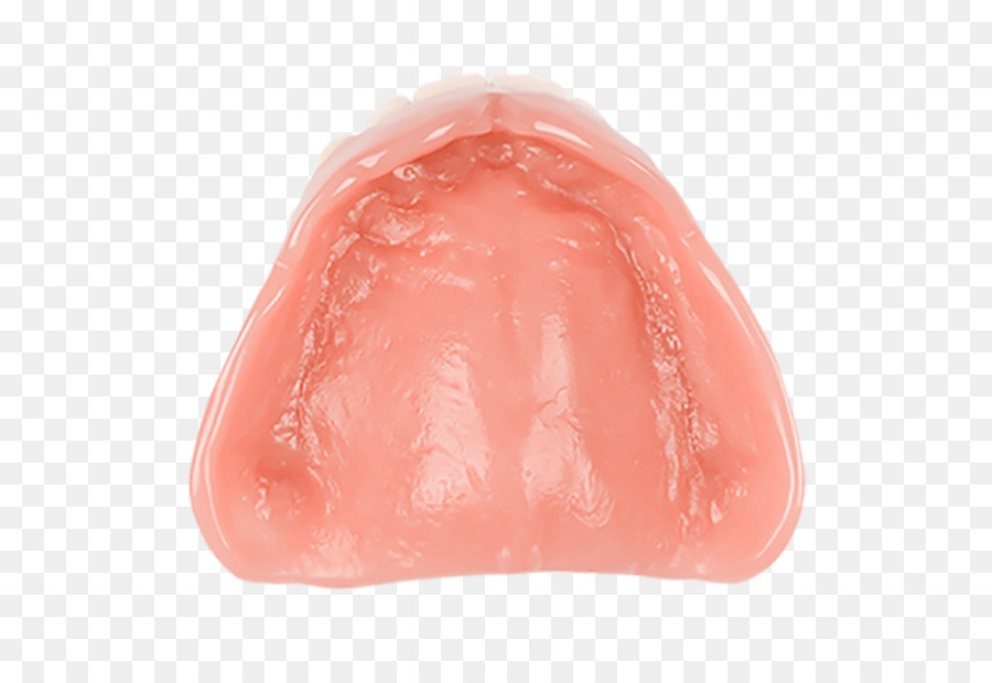Zahnersatz Zahnmedizin Aspen Dental Preis - Aspen Dental
