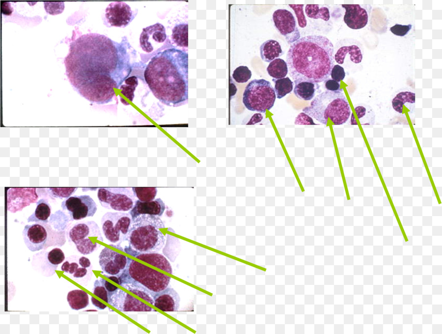 Pianta a fioritura Promyelocyte - delle cellule di schwann