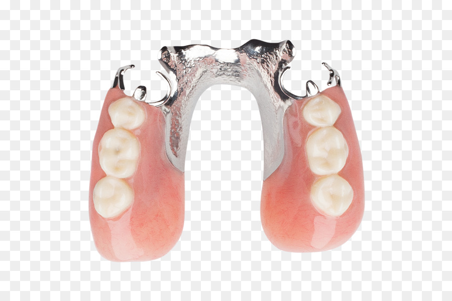 Denti umani Protesi parziale Rimovibile protesi dentaria Odontoiatria - Aspen Dentaria