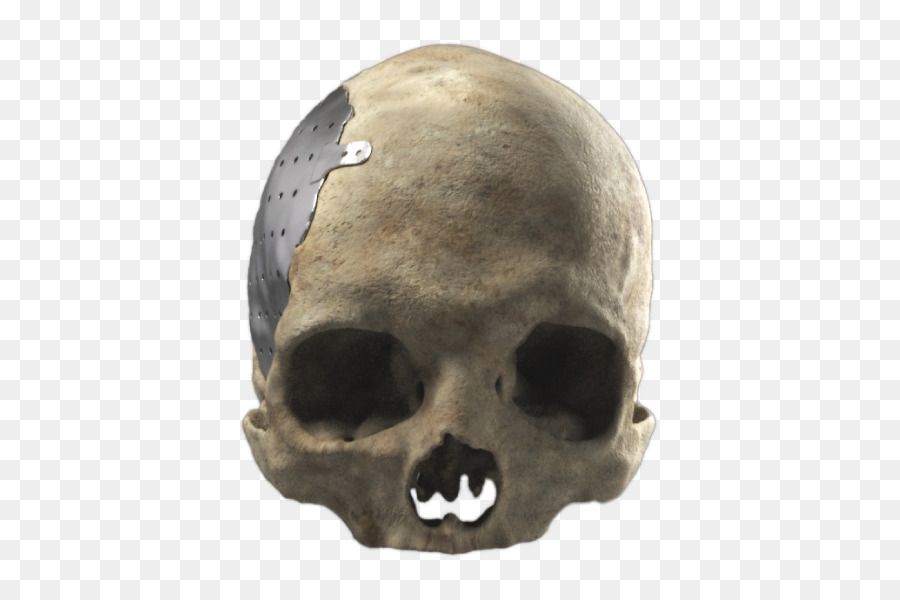 Cranioplasty Poly Cranio Muso Scheletro - cranio