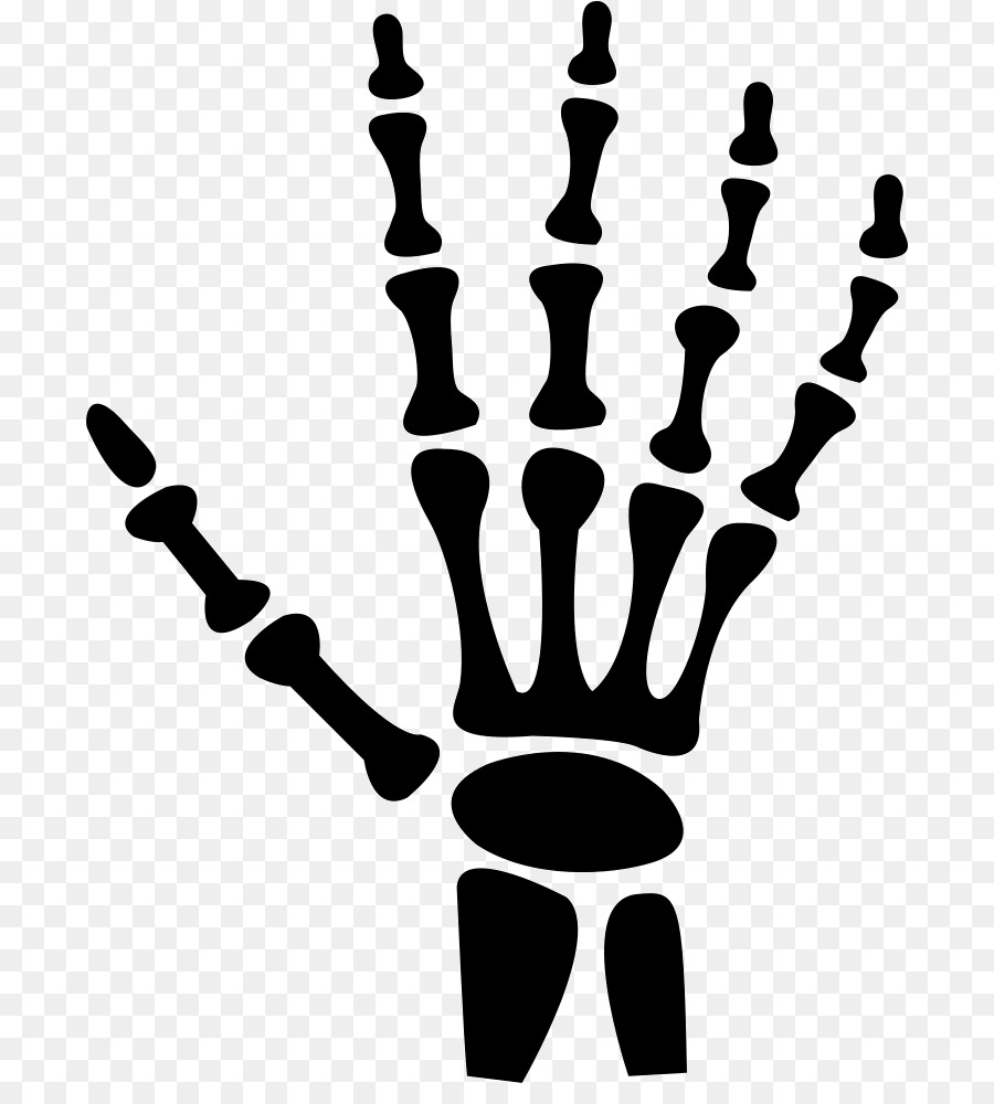 Hand X-ray Radiologie Menschlichen Körper - Hand