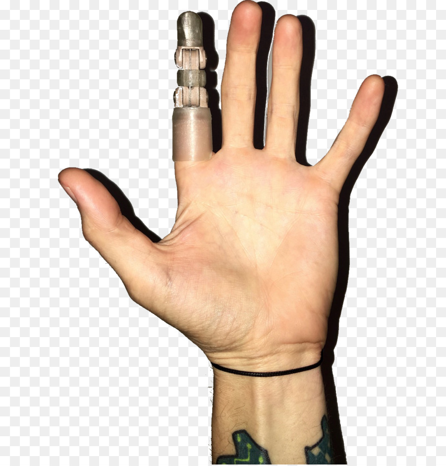 Daumen-Prothese-Hand-Modell-Finger-Handschuh - 3d Druck
