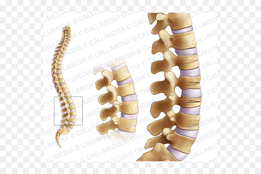Fratture Articolari Osteoporosi collo Femorale Reumatologia - L'osteoporosi