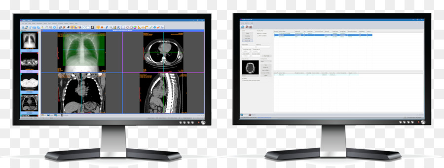 Monitor di Computer al dispositivo di Uscita dispositivo di Visualizzazione a schermo Piatto Monitor del Computer Accessorio - multi monitor