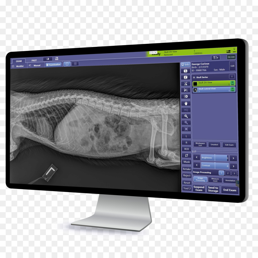 Digitale Radiographie Canon Medical Systems Corporation, Computer-Monitore, Digital imaging - Porcupine