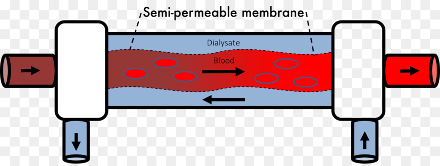 Hämodialyse Transmembrane protein Druck - Hämodialyse