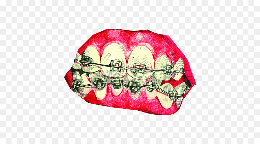 Mund Zahn Sündigen Volk: Ein Roman des Mittelalters Zahnspangen - andere