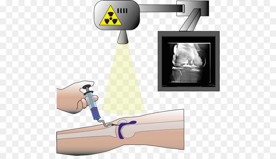 Injektion Radiologie Arthrogram Computertomographie Magnetresonanztomographie - St. Thomas