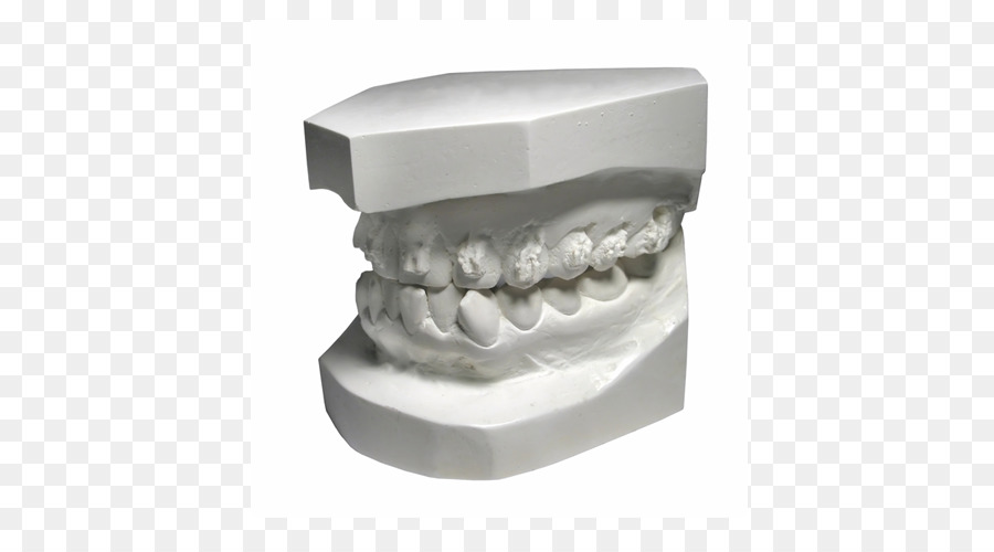 Odontoiatria, denti Umani - igienista dentale