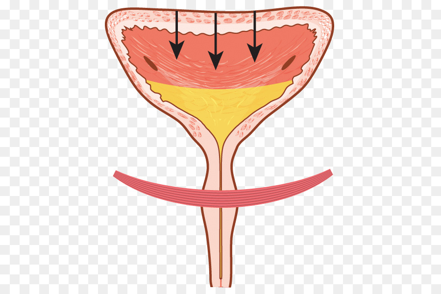 Iperattiva vescica Urinaria incontinenza della vescica Urinaria, ritenzione Urinaria Minzione - vescica iperattiva