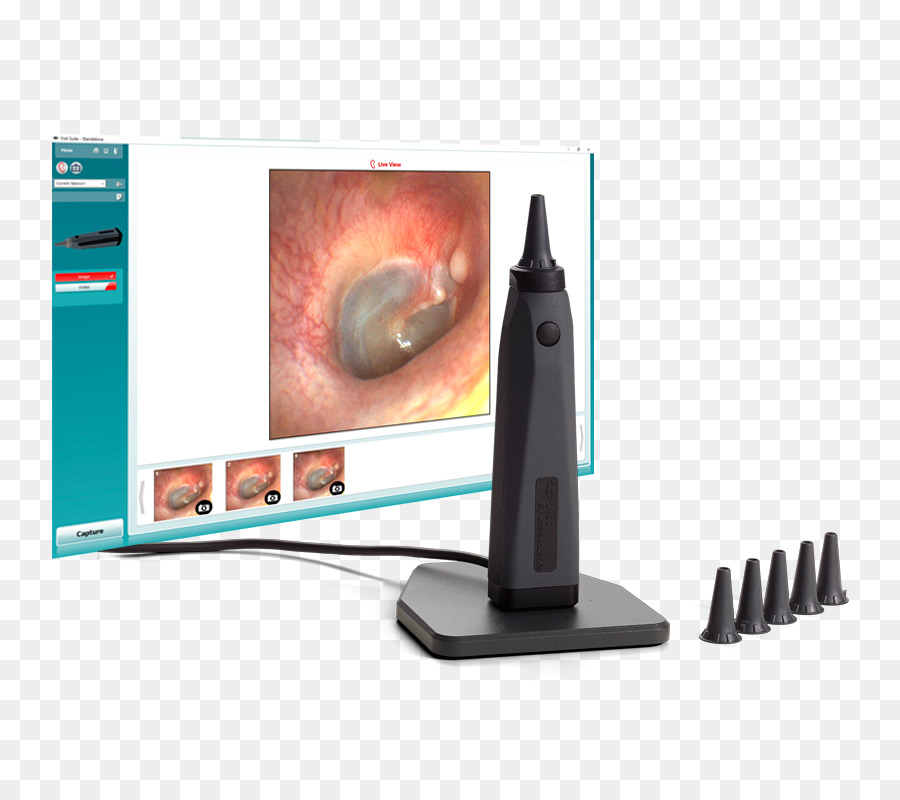 Otoskop Audiometrie Computer Monitore Otoscopia Otoskopie - ahsaudiology Hörlösungen