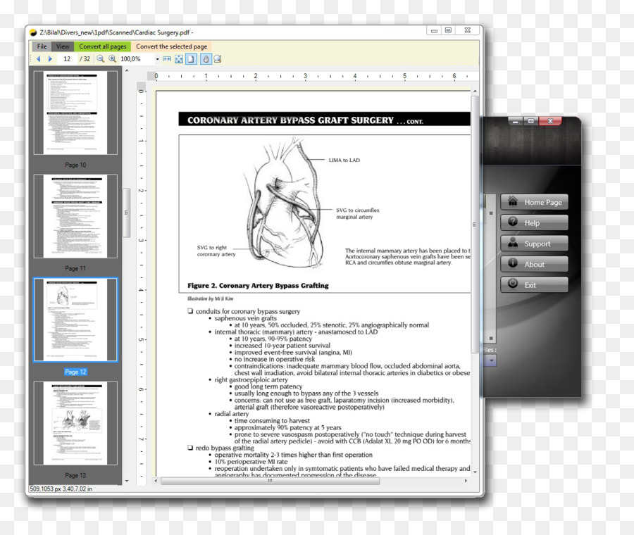 Quang nhân vật nhận dạng hình Ảnh quét Microsoft Từ PDF TIFF - TIFF