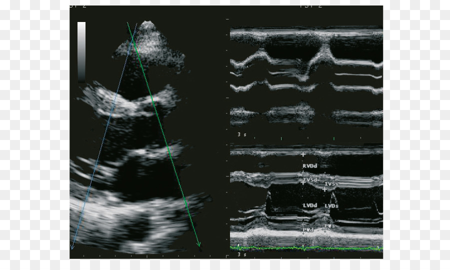 Sonographie Ultraschall Kardiologie Ecógrafo Radiologie - fortschrittliche Technologie