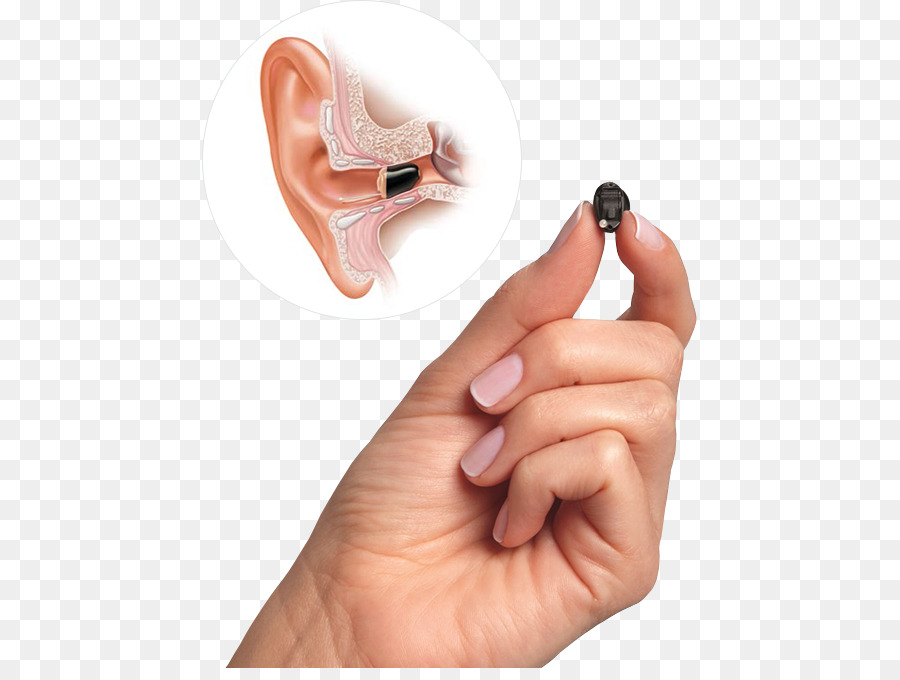 Primäre Hörakustik Hörgeräte - Ohr