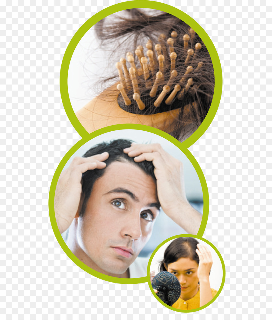 La gestione della perdita di capelli, trapianto di Capelli dei capelli Umani di crescita - La perdita dei capelli